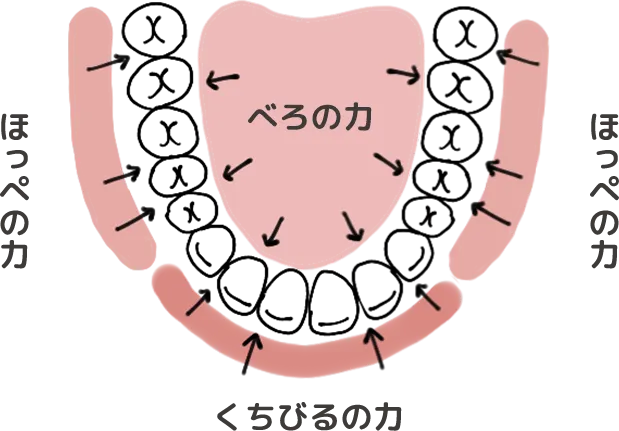 MFT（口腔筋機能療法）