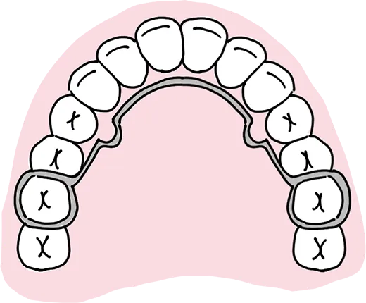 リンガルアーチ