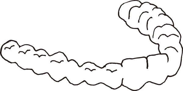 透明マウスピース矯正